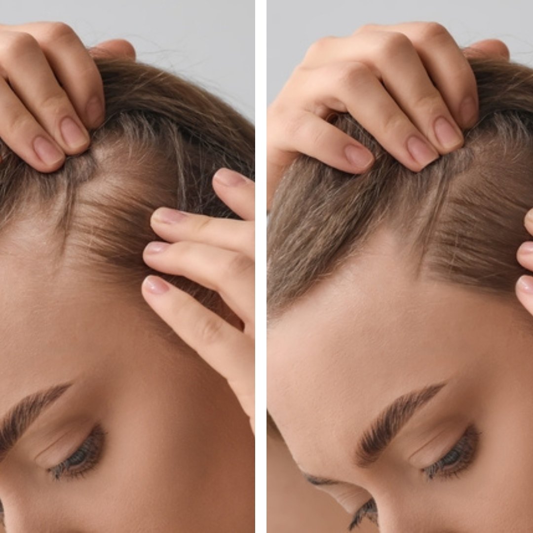 Miracles Hemp & Biotin Hair Growth Conditioner